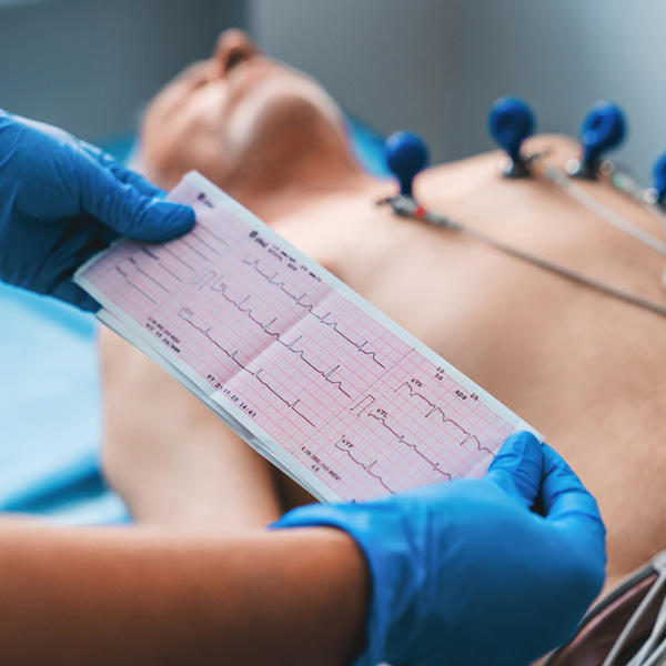 مخطط كهربائية القلب (ECG)