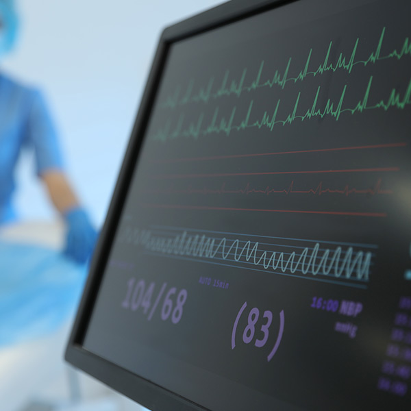 Cardiac event recording device in Dubai London Hospital