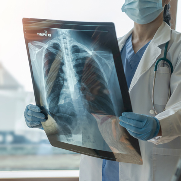 X-ray imaging services in Dubai London Hospital